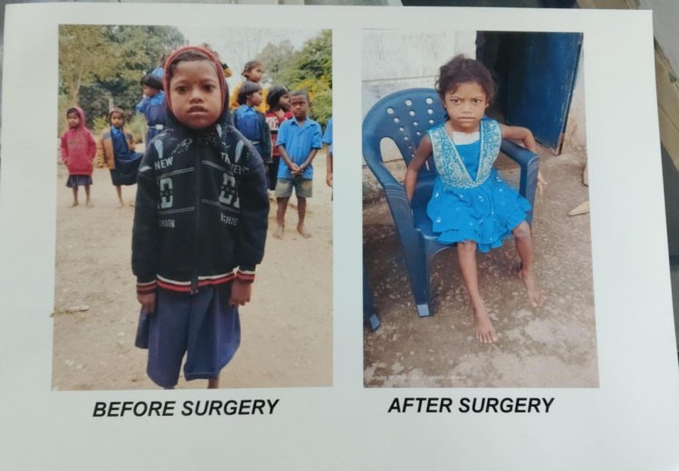 हृदय रोग से पीड़ित दिव्या ऑपरेशन के बाद जी रही है सामान्य जीवन चिरायु योजना बनी वरदान